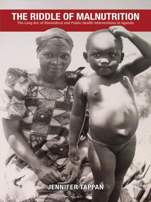 cover image of The Riddle of Malnutrition